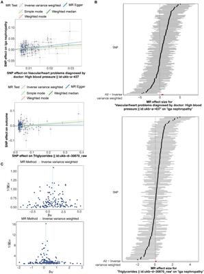 The causal effect of triglyceride and high blood pressure on IgA nephropathy: a Mendelian randomization study